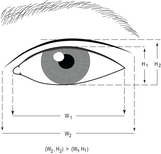Asian Eyelid Surgery Center